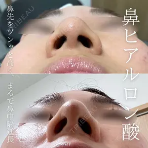 X CLINIC 福岡天神院 倉光　瞳医師の症例