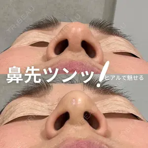 X CLINIC 福岡天神院 倉光　瞳医師の症例