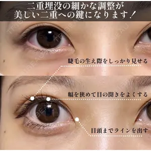 X CLINIC 恵比寿院の症例