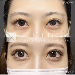 X CLINIC 恵比寿院の症例