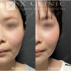 X CLINIC 恵比寿院の症例