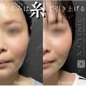 X CLINIC 恵比寿院の症例