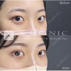 X CLINIC 恵比寿院の症例