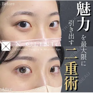 X CLINIC 恵比寿院の症例