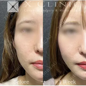 X CLINIC 恵比寿院の症例