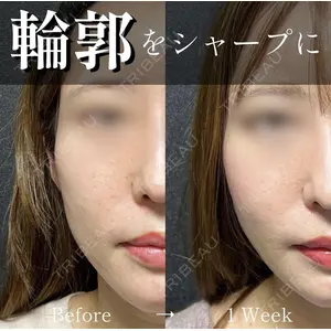 X CLINIC 恵比寿院の症例