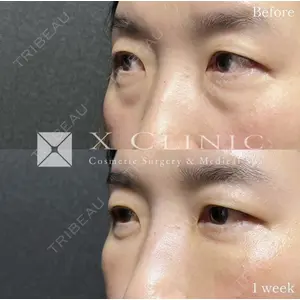 X CLINIC 恵比寿院の症例