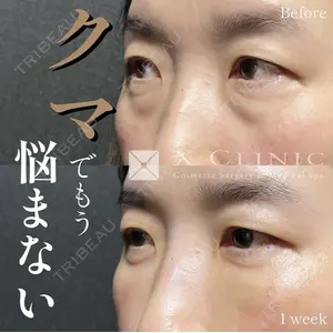 X CLINIC 恵比寿院の症例