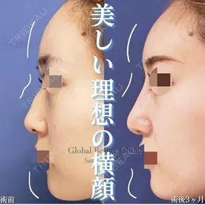 グローバルビューティークリニック 大阪院の症例
