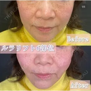 ルラ美容クリニック 渋谷本院 昼間 路子医師の症例