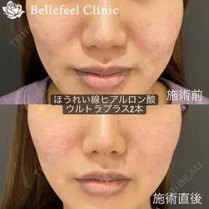 Bellefeel Clinic 代官山 兵藤 秀忠 医師の症例