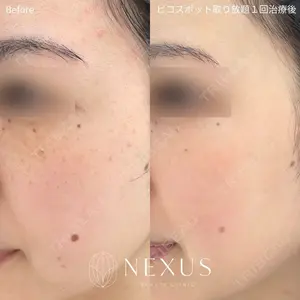 NEXUS CLINIC 酒井　知子医師の症例