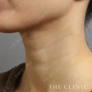 THE CLINIC（ザ・クリニック） 東京院の症例
