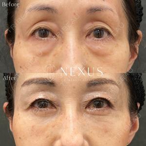 NEXUS CLINICの症例