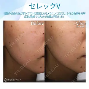 聖心美容クリニック 熱海院 小林 美幸（皮膚科）医師の症例