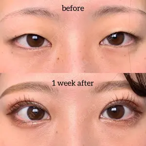 EMMO FACE CLINIC 大阪梅田院の症例