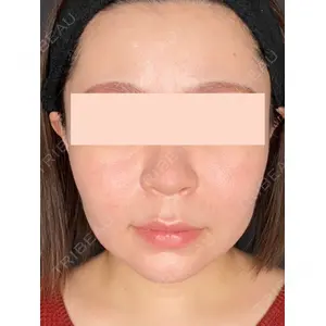 Wi Clinic（ウィ クリニック） 吉祥寺院の症例
