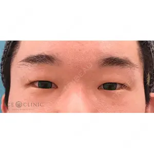 エースクリニック 大阪梅田HEPナビオ院の症例
