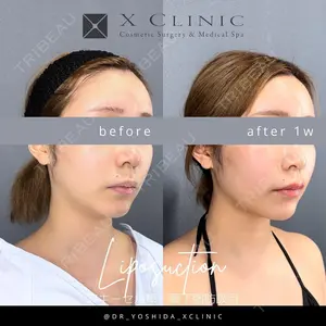 X CLINIC 銀座院の症例