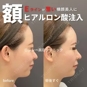 ロレシー美容クリニック 心斎橋駅前院 高田先生医師の症例