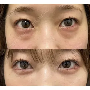 EMMO FACE CLINIC 大阪梅田院の症例
