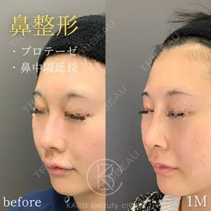 KARIS beauty clinic 滝内 ヒロフミ医師の症例
