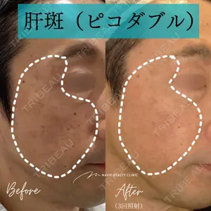 Mavie Beauty Clinic （マヴィービューティークリニック）の症例