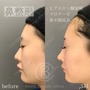 KARIS beauty clinic 滝内 ヒロフミ医師の症例