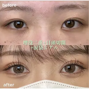 EMMO FACE CLINIC 大阪梅田院の症例