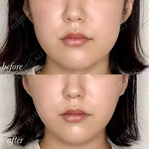 APスキンクリニック銀座の症例
