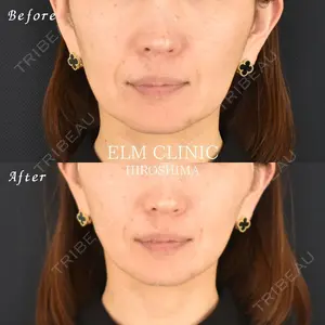 美容皮膚科エルムクリニック 福岡院の症例