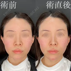 HAAB×DREAM BEAUTY CLINIC 大阪梅田院 柏木 太雅医師の症例