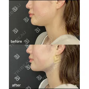 EMMO FACE CLINIC 大阪梅田院の症例