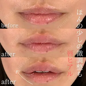 KARIS beauty clinic 滝内 ヒロフミ医師の症例