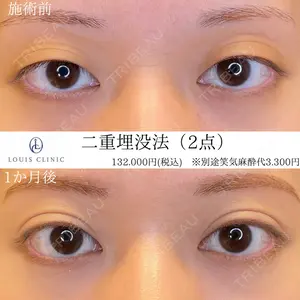 LOUIS CLINIC 二子玉川院【ルイクリニック】 小松 塁医師の症例