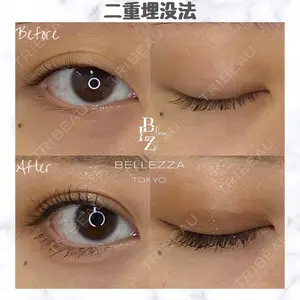東京BELLEZZAクリニックの症例