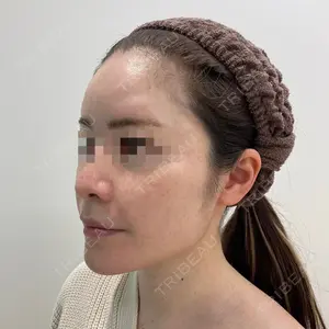 ユウコ形成外科クリニック 植田　有子医師の症例