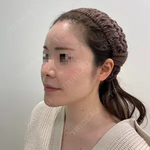 ユウコ形成外科クリニック 植田　有子医師の症例