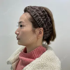 ユウコ形成外科クリニック 植田　有子医師の症例