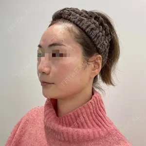 ユウコ形成外科クリニック 植田　有子医師の症例
