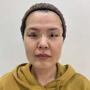 ユウコ形成外科クリニック 植田　有子医師の症例