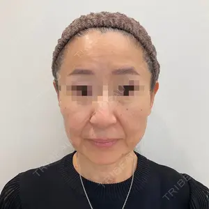 ユウコ形成外科クリニック 植田　有子医師の症例