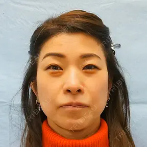 麹町皮ふ科・形成外科クリニックの症例