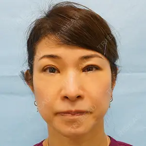 麹町皮ふ科・形成外科クリニックの症例