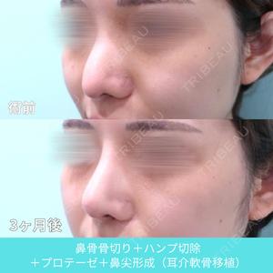 WOM CLINIC GINZA （ワム クリニック ギンザ） 佐々木 和司医師の症例