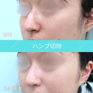 WOM CLINIC GINZA （ワム クリニック ギンザ） 佐々木 和司医師の症例