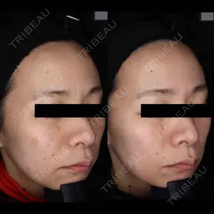 美容皮膚科エルムクリニック 福岡院の症例