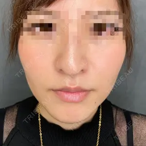ルラ美容クリニック 渋谷本院 昼間 路子医師の症例