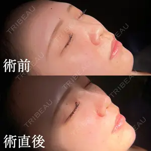 HAAB×DREAM BEAUTY CLINIC 東京本院 佐野 圭医師の症例