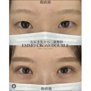 EMMO FACE CLINIC 大宮院 廣松 直樹医師の症例